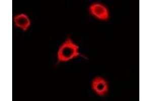 Immunofluorescent analysis of Rac 1 staining in A549 cells. (RAC1 抗体)