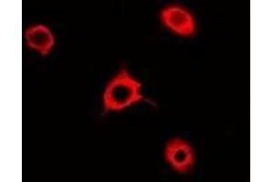 Immunofluorescent analysis of Rac 1 staining in A549 cells. (RAC1 抗体)