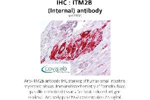 Image no. 1 for anti-Integral Membrane Protein 2B (ITM2B) (Internal Region) antibody (ABIN1736083) (ITM2B 抗体  (Internal Region))