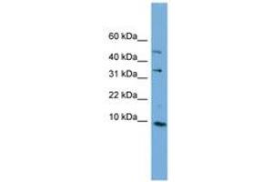 Image no. 1 for anti-Chromosome 16 Open Reading Frame 61 (C16orf61) (C-Term) antibody (ABIN6744182) (C16orf61 抗体  (C-Term))
