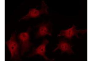 ABIN6269036 staining HeLa by IF/ICC.