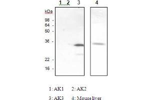 Western Blotting (WB) image for anti-Adenylate Kinase 3 (AK3) antibody (ABIN165376) (Adenylate Kinase 3 抗体)