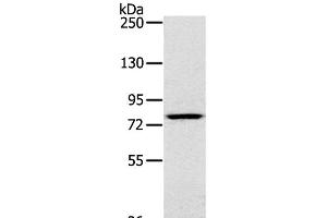 Western Blot analysis of K562 cell using RPS6KA1 Polyclonal Antibody at dilution of 1:400 (RPS6KA1 抗体)