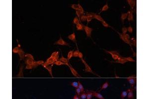 Immunofluorescence analysis of NIH/3T3 cells using SLC25A38 Polyclonal Antibody at dilution of 1:100. (SLC25A38 抗体)