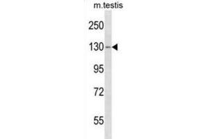 Western Blotting (WB) image for anti-TBC1 Domain Family, Member 2 (TBC1D2) antibody (ABIN5019936) (TBC1D2 抗体)