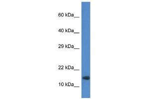 WB Suggested Anti-Rnf122 Antibody   Titration: 1. (RNF122 抗体  (Middle Region))