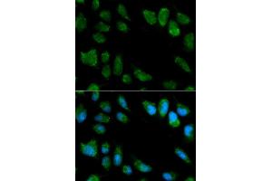 Immunofluorescence analysis of MCF7 cell using IL1RN antibody.