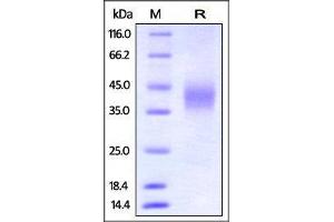 SDS-PAGE (SDS) image for Fc Fragment of IgG, Low Affinity IIIa, Receptor (CD16a) (FCGR3A) (AA 32-215) (Active) protein (His tag) (ABIN2870739)