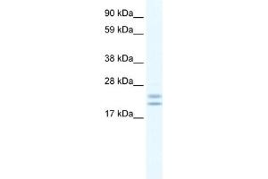 WB Suggested Anti-Tppp Antibody Titration:  0. (Tppp 抗体  (C-Term))