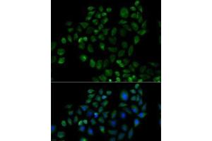 Immunofluorescence analysis of HeLa cells using FABP2 Polyclonal Antibody (FABP2 抗体)