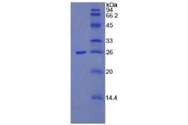 PTX3 Protein (AA 183-381)
