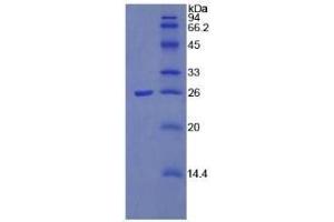 SDS-PAGE (SDS) image for Pentraxin 3 (PTX3) (AA 183-381) protein (ABIN7405523) (PTX3 Protein (AA 183-381))