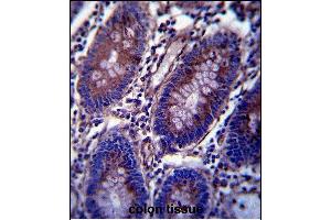 Vimentin Antibody (C-term) (ABIN389212 and ABIN2839367) immunohistochemistry analysis in formalin fixed and paraffin embedded human colon tissue followed by peroxidase conjugation of the secondary antibody and DAB staining. (Vimentin 抗体  (C-Term))