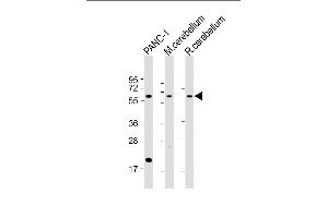 All lanes : Anti-SLC11A2 Antibody (Center) at 1:2000 dilution Lane 1: NC-1 whole cell lysate Lane 2: mouse cerebellum lysate Lane 3: rat cerebellum lysate Lysates/proteins at 20 μg per lane. (SLC11A2 抗体  (AA 262-291))