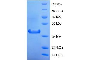 SDS-PAGE (SDS) image for Protein Tyrosine Phosphatase, Receptor-Type, Z Polypeptide 2 (PTPRZ2) (AA 36-300) protein (His tag) (ABIN5713774)