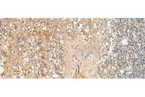 Immunohistochemistry of paraffin-embedded Human tonsil tissue using GPR27 Polyclonal Antibody at dilution of 1:25(x200) (GPR27 抗体)