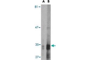 Western blot analysis of ENDOG expression in HepG2 cell lysate with ENDOG monoclonal antibody, clone 7G1C10  at (A) 2. (Endonuclease G 抗体  (AA 76-170))
