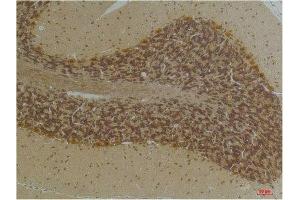 Immunohistochemistry (IHC) image for anti-Potassium Intermediate/small Conductance Calcium-Activated Channel, Subfamily N, Member 2 (KCNN2) antibody (ABIN7189257)