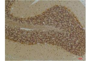 Immunohistochemical analysis of paraffin-embedded Human BrainTissue using KCNN2(SK2) Rabbit pAb diluted at 1:200. (KCNN2 抗体)