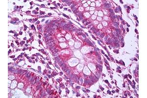Immunohistochemistry (IHC) image for anti-Prohibitin (PHB) antibody (ABIN961915)
