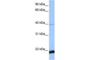 Western Blotting (WB) image for anti-HBS1-Like (HBS1L) antibody (ABIN2463501) (HBS1L 抗体)