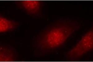 Immunofluorescence staining of methanol-fixed Hela cells, using Phospho-RB1-S780 antibody. (Retinoblastoma 1 抗体  (pSer780))