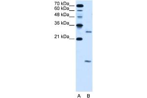 WB Suggested Anti-VMA21 Antibody Titration:  5. (VMA21 抗体  (N-Term))