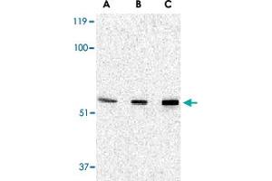 Western blot analysis of PAK2 in Jurkat lysate with PAK2 polyclonal antibody  at (A) 0. (PAK2 抗体  (N-Term))