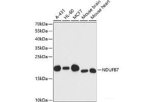 Western blot analysis of extracts of various cell lines using NDUFB7 Polyclonal Antibody at dilution of 1:3000. (NDUFB7 抗体)