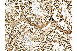 ABIN7094465 and ABIN7098513 at 1/100 staining Rat testis tissue by IHC-P. (Retinoid X Receptor beta 抗体  (N-Term))