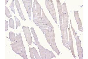 IHC analysis of PCDH15 using anti-PCDH15 antibody (ABIN6719362).