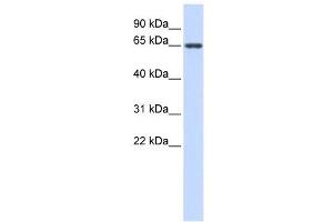 AMH antibody used at 1 ug/ml to detect target protein. (AMH 抗体  (Middle Region))