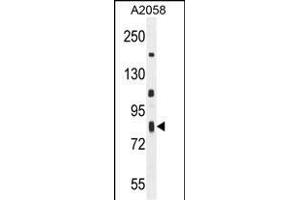C6orf70 Antibody (Center) (ABIN654987 and ABIN2844625) western blot analysis in  cell line lysates (35 μg/lane). (C6orf70 抗体  (AA 346-375))