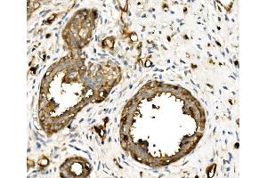 IHC analysis of MSN using anti-MSN antibody (ABIN7600378). (Moesin 抗体  (AA 184-568))