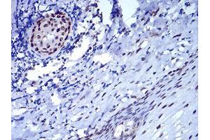 Immunohistochemistry (IHC) image for anti-Chromobox Homolog 5 (CBX5) (AA 1-191) antibody (ABIN5542711)