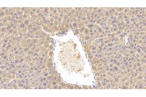 Detection of LCAT in Mouse Liver Tissue using Polyclonal Antibody to Lecithin Cholesterol Acyltransferase (LCAT) (LCAT 抗体  (AA 290-432))