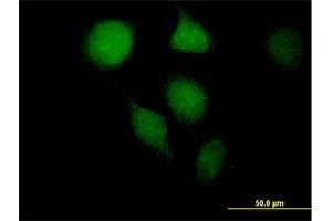 Immunofluorescence of purified MaxPab antibody to OGG1 on HeLa cell. (OGG1 抗体  (AA 1-324))