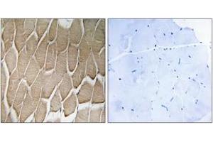 Immunohistochemistry analysis of paraffin-embedded human skeletal muscle, using RAB34 Antibody. (RAB34 抗体  (AA 206-255))