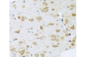 Immunohistochemistry of paraffin-embedded Mouse brain using Gm13125 Polyclonal Antibody at dilution of 1:100 (40x lens). (Pramel15 抗体)
