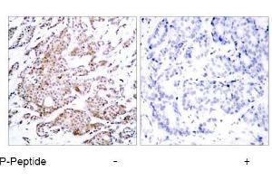 Image no. 1 for anti-Myc Proto-Oncogene protein (MYC) (pThr58) antibody (ABIN196672) (c-MYC 抗体  (pThr58))