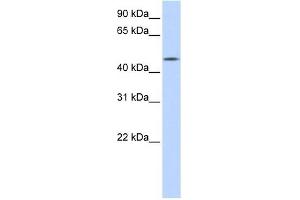 C20ORF160 antibody used at 1 ug/ml to detect target protein. (C20orf160 抗体  (N-Term))