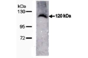 Image no. 4 for anti-Transmembrane Protein 67 (TMEM67) (C-Term) antibody (ABIN347657) (TMEM67 抗体  (C-Term))