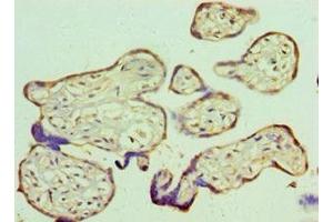 Immunohistochemistry of paraffin-embedded human placenta tissue using ABIN7167786 at dilution of 1:100 (RBBP5 抗体  (AA 319-538))