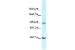 Image no. 1 for anti-DEAD (Asp-Glu-Ala-Asp) Box Polypeptide 23 (DDX23) (AA 662-711) antibody (ABIN6747808) (DDX23 抗体  (AA 662-711))