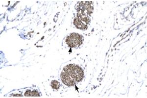 Human urinary bladder (MMP19 抗体  (N-Term))
