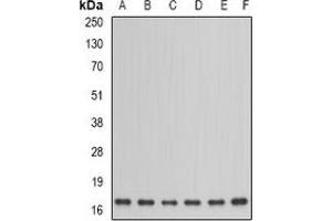 Western blot analysis of NDUFA12 expression in HepG2 (A), PC12 (B), mouse kidney (C), mouse testis (D), rat heart (E), rat brain (F) whole cell lysates. (NDUFA12 抗体)