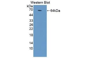 Detection of Recombinant MyD88, Rat using Polyclonal Antibody to Myeloid Differentiation Factor 88 (MyD88) (MYD88 抗体  (AA 1-296))