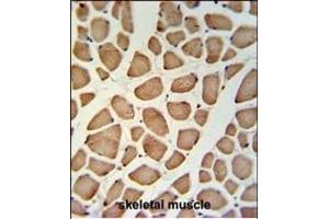 GPSN2 Antibody (C-term) (ABIN653745 and ABIN2843047) IHC analysis in formalin fixed and paraffin embedded skeletal muscle followed by peroxidase conjugation of the secondary antibody and DAB staining. (TECR 抗体  (C-Term))