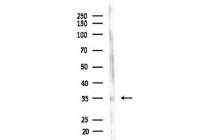 anti-Capping Protein (Actin Filament) Muscle Z-Line, alpha 1 (CAPZA1) (Internal Region) antibody