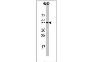 Image no. 1 for anti-Tripartite Motif Containing 69 (TRIM69) (Middle Region) antibody (ABIN357769) (TRIM69 抗体  (Middle Region))